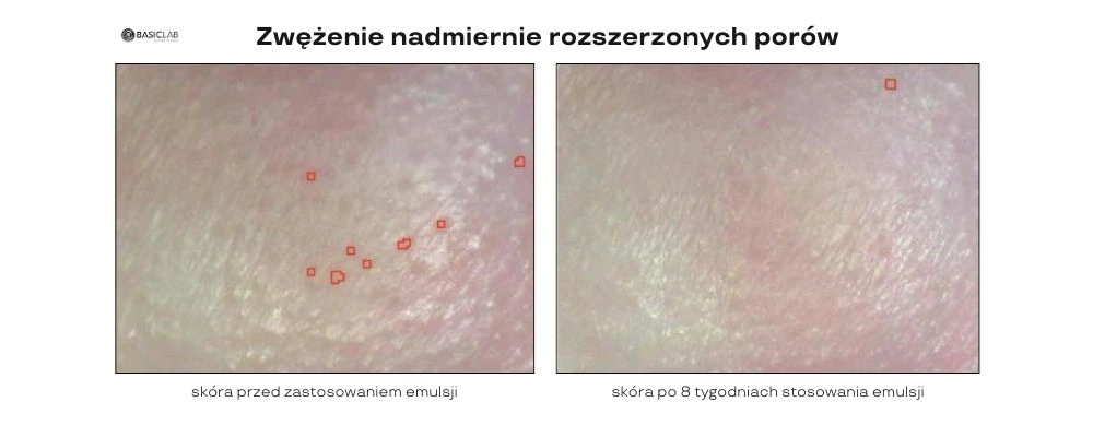 lekka emulsja normalizująca zredukowane pory